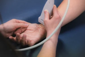 ultrasound guided carpal tunnel procedure